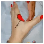 ##