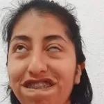 lalo